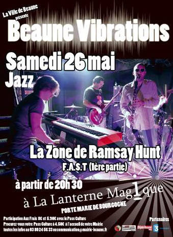 La_zone_de_ramsay_hunt_Lanterne_magique.png